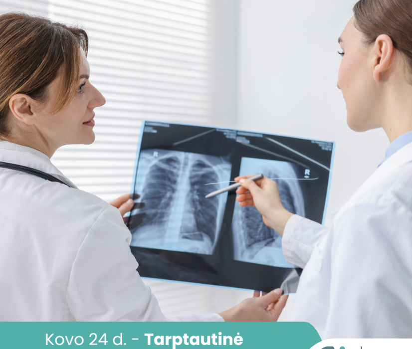 Tuberkuliozė: ką būtina žinoti kiekvienam